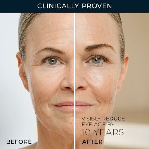 Before and after comparison of anti-aging skincare effect on woman's face.