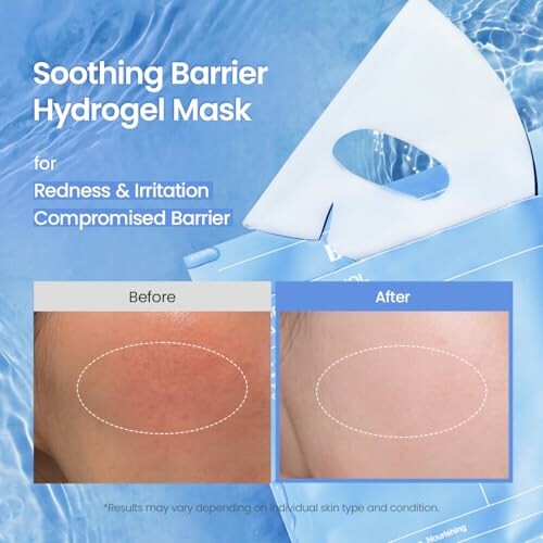 Hydrogel mask for redness and irritation with before and after results.
